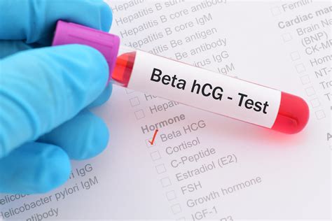 Teste de gravidez Beta hCG: aprenda a interpretar os resultados